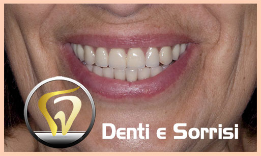 miglior-dentista-odontoiatra-croazia-12