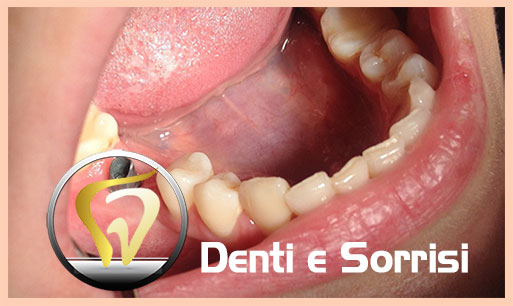 miglior-dentista-odontoiatra-croazia-15