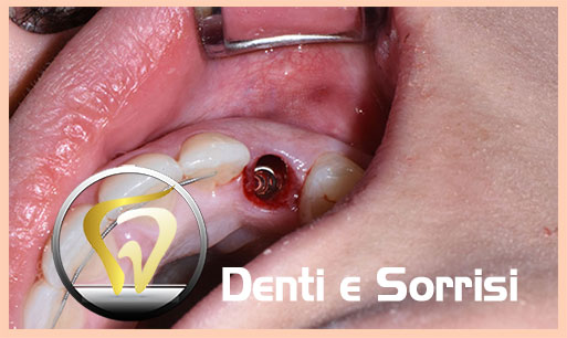 miglior-dentista-odontoiatra-in-croazia-16