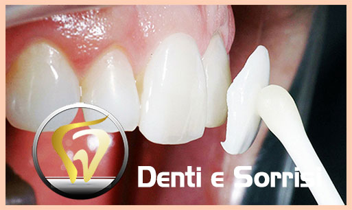 miglior-dentista-odontoiatra-a-spalato-17
