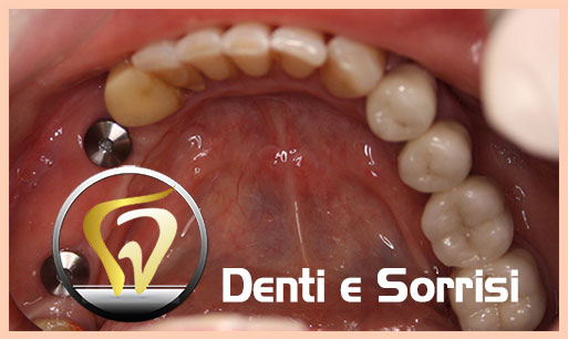 miglior-dentista-odontoiatra-a-zagabria-19