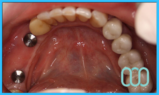 policlinico-odontoiatrico-a-zagabria-19