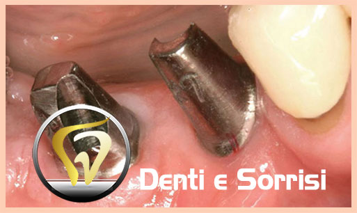 dentista-low-cost-a-fiume-20