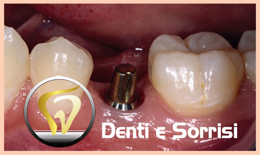 miglior-dentista-odontoiatra-fiume-22
