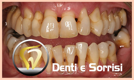 miglior-dentista-odontoiatra-croazia-23