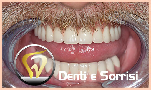 miglior-dentista-odontoiatra-a-spalato-24