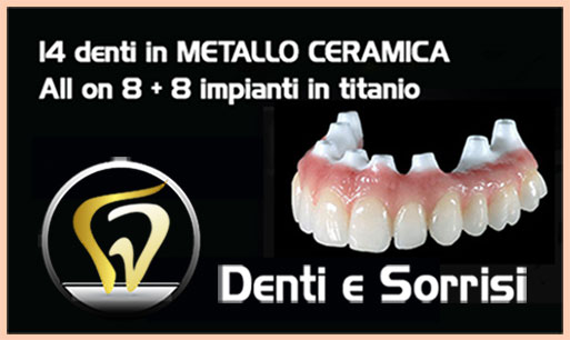 dentista-low-cost-in-croazia-9