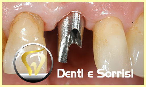 dentista-low-cost-moldavia-sos-13