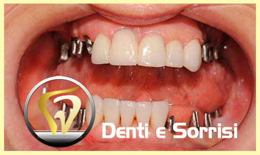 miglior-dentista-odontoiatra-moldavia-14