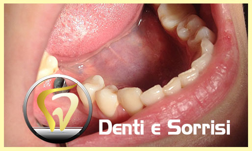 miglior-dentista-odontoiatra-moldavia-15