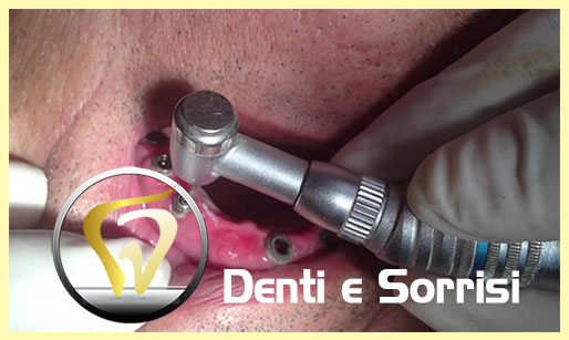 dentista-low-cost-moldavia-sos-18
