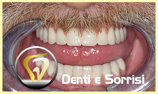 dentista-sos-moldavia-24