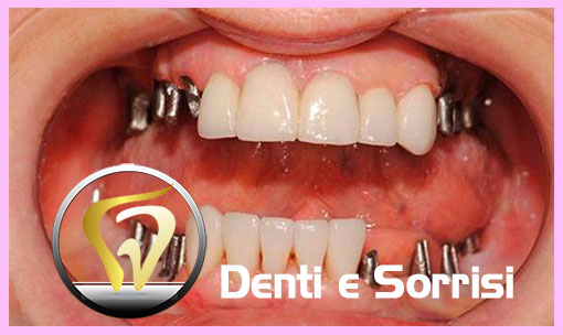dentista-low-cost-a-praga-14