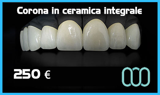 prezzo-corona-in-ceramica-integrale-in-repubblica-ceca-a-praga-3