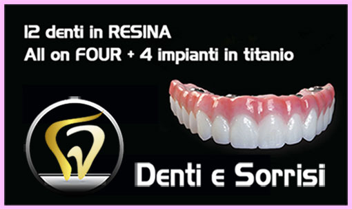 prezzo-all-on-eight-con-14-denti-in-metallo-ceramica-e-8-impianti-in-titanio-7