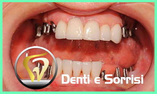 miglior-dentista-odontoiatra-in-serbia-14