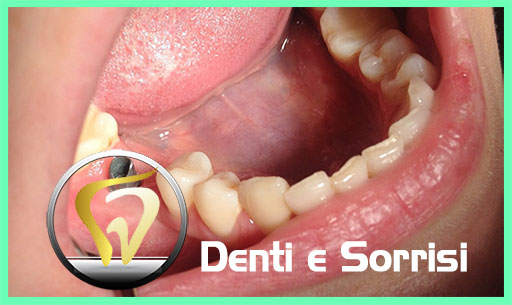 miglior-dentista-odontoiatra-a-belgrado-15