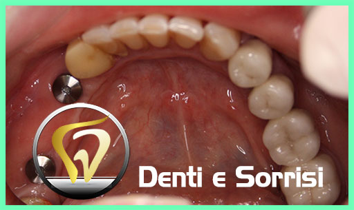 miglior-dentista-odontoiatra-serbia-19