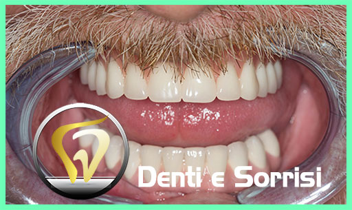 miglior-dentista-odontoiatra-a-belgrado-24