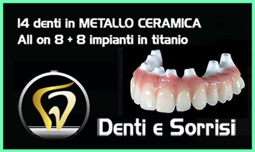 dentista-prezzi-serbia-9
