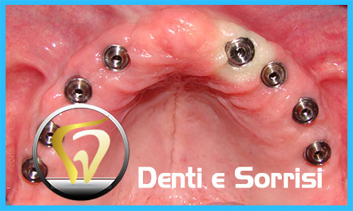 miglior-dentista-odontoiatra-in-ungheria-11