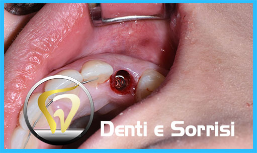 miglior-dentista-odontoiatra-in-ungheria-16