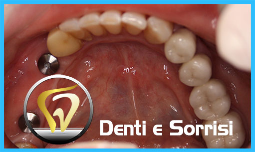 miglior-dentista-odontoiatra-ungheria-19