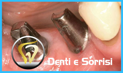 miglior-dentista-odontoiatra-ungheria-20