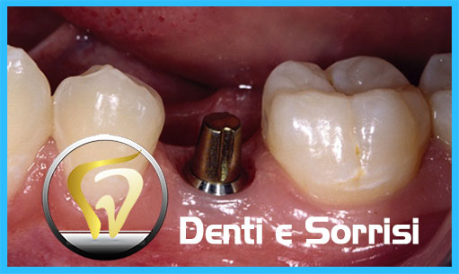 dentista-low-costi-in-ungheria-22
