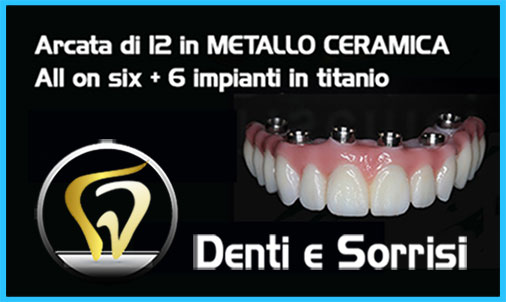 Turismo dentale in Italia 8