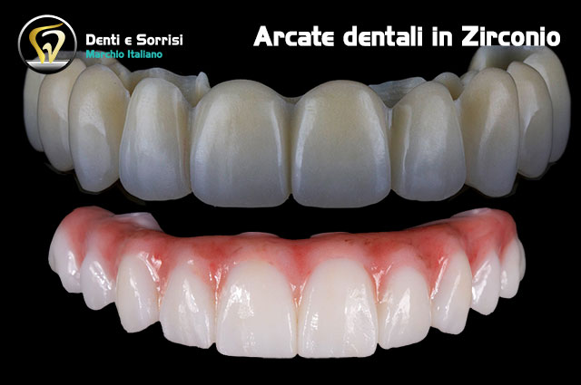 blog-arcate-dentali-in-zirconio