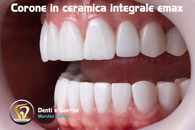 blog-blog-corone-in-ceramica-integrale-emax