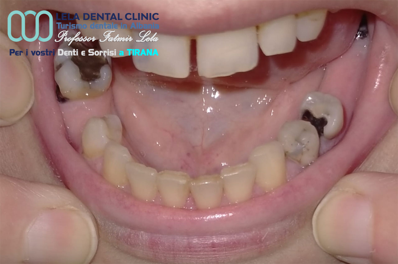 blog-post-cure-dentali