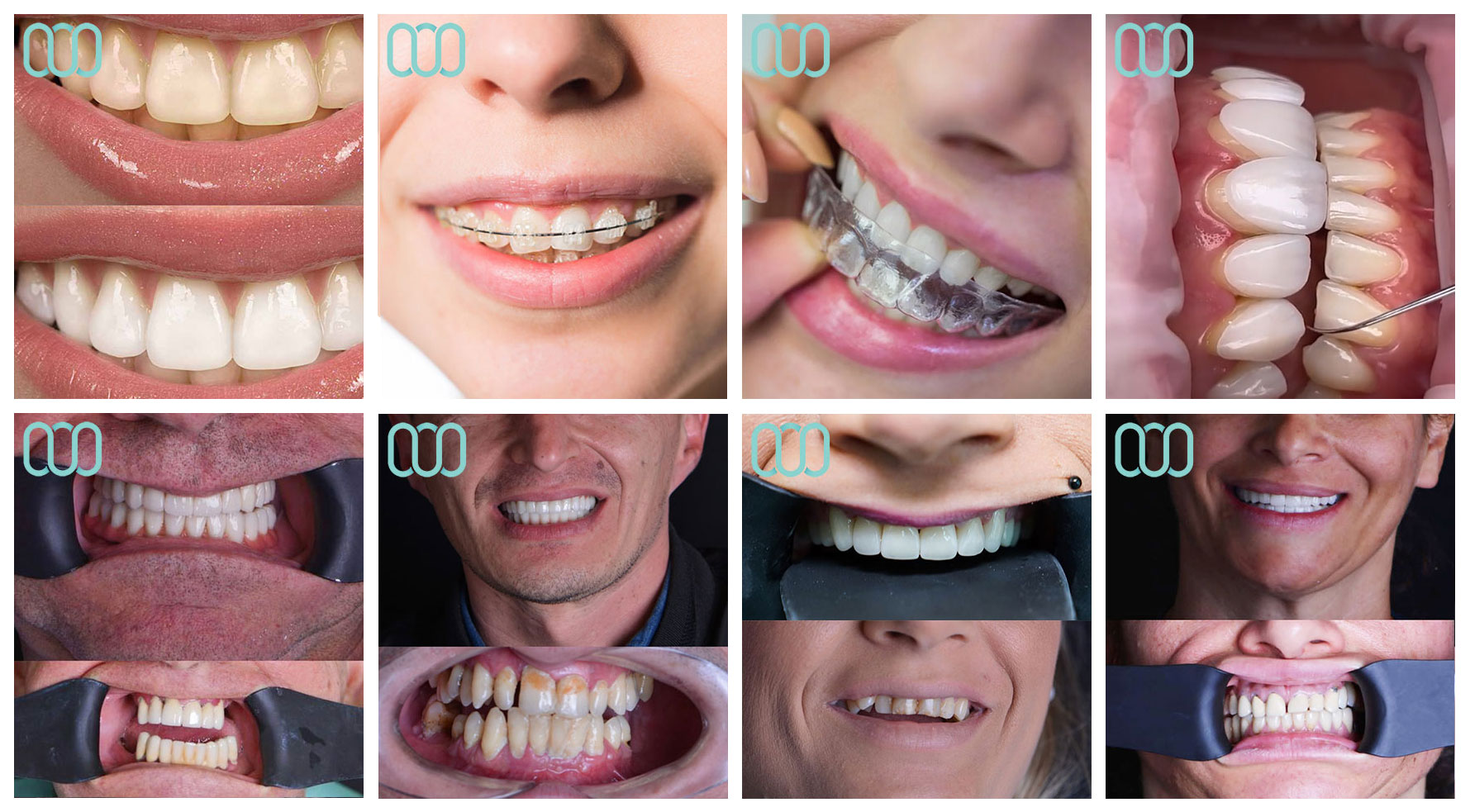 migliori-dentisti-in-albania