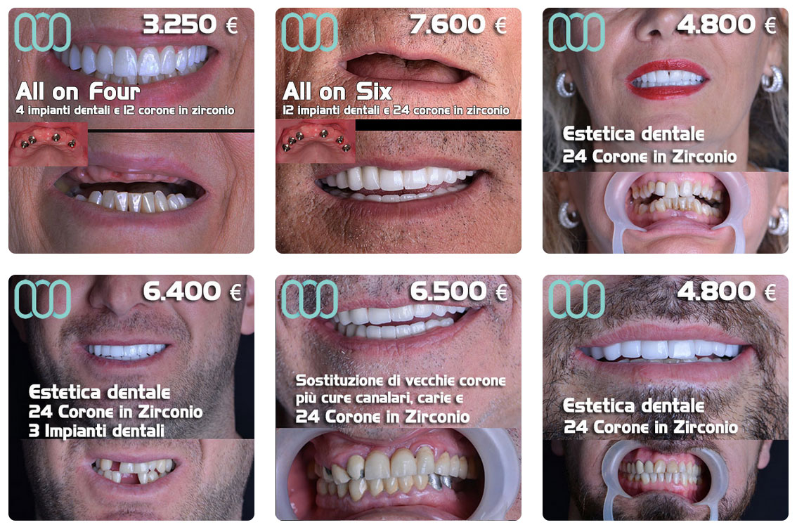 le-migliori-offerte-sul-turismo-dentale-in-Albania