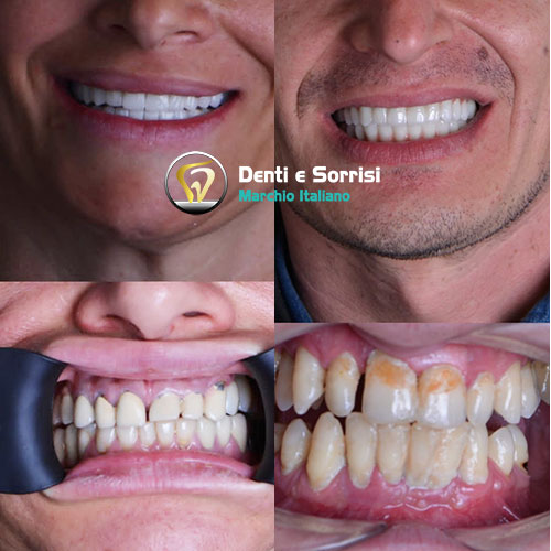 blog-post-sulla-estetica-dentale