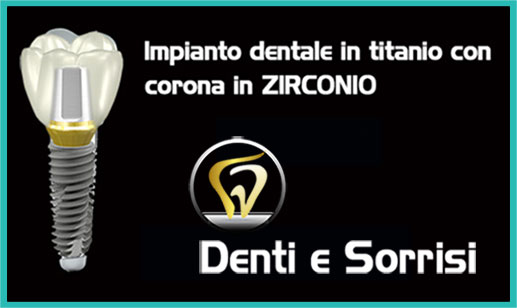 Dentista economico a Cuneo prezzi 6