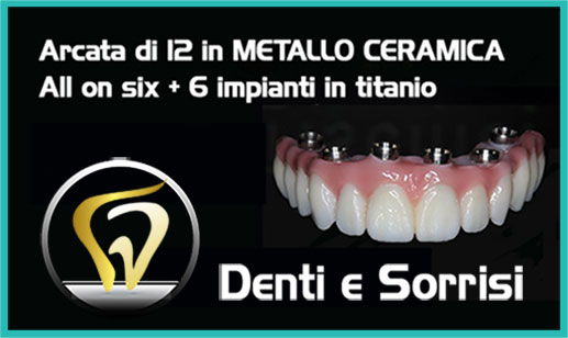 Dentista economico a Campomarino prezzi 8