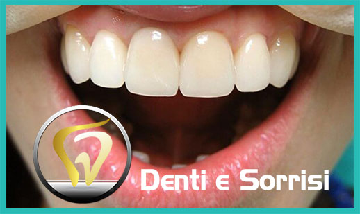 Dentista low cost Sassuolo prezzi 21