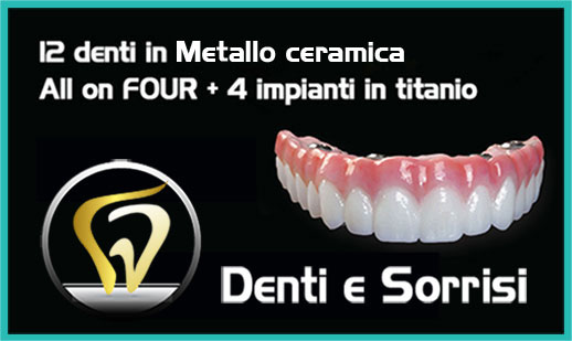 Dentista low cost Novara prezzi 7