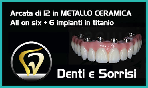 Dentista low cost Francavilla Fontana prezzi 8