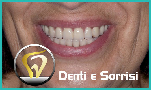 Dentista low cost Termoli 12