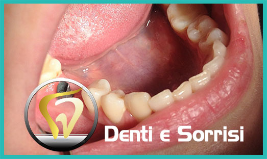 Dentista low cost Portocannone 15