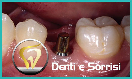 Dentista low cost Brescia 22