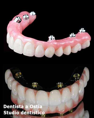 dentista-Ostia-arcate-dentarie