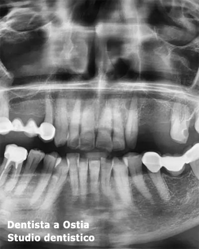 dentista-Ostia-orto-panoramica