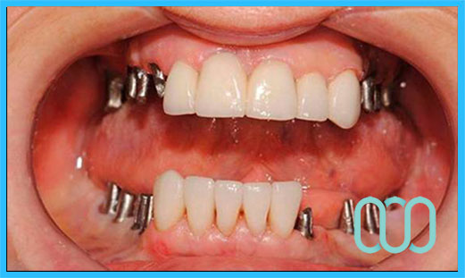Dentista bravo economico Genzano di Roma 14