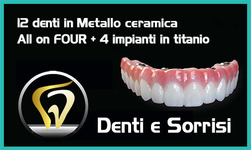Dentista bravo economico Spallette 7
