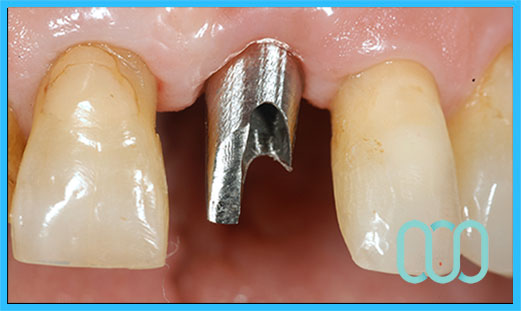 Estetica dentale costo e prezzi a Frosolone 13