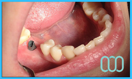 Estetica-dentale-a-Treviso 15